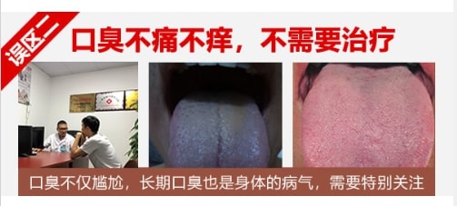 口臭不疼不痒、不需要治疗