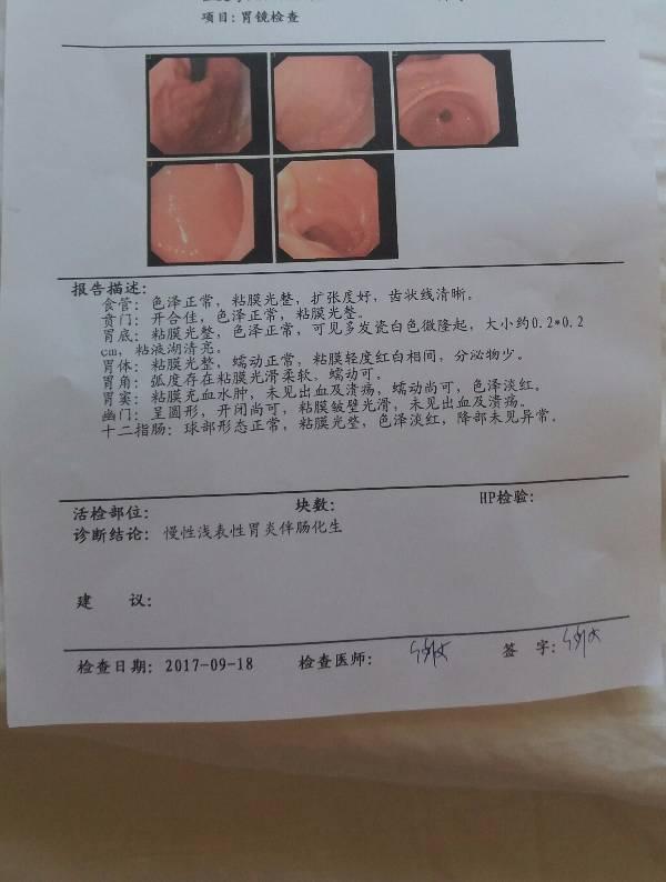 胃镜检查结果