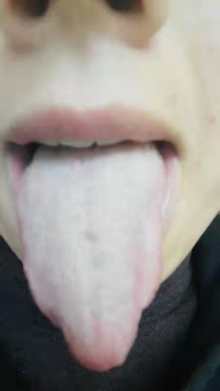口臭舌苔