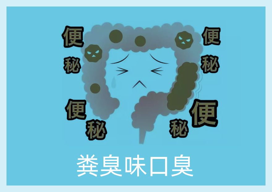 肠道宿便