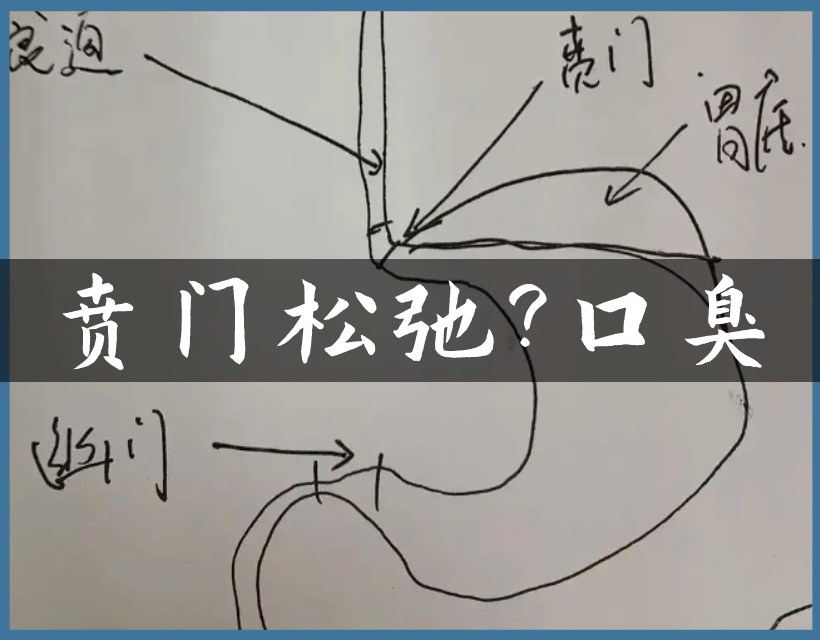 贲门部位图
