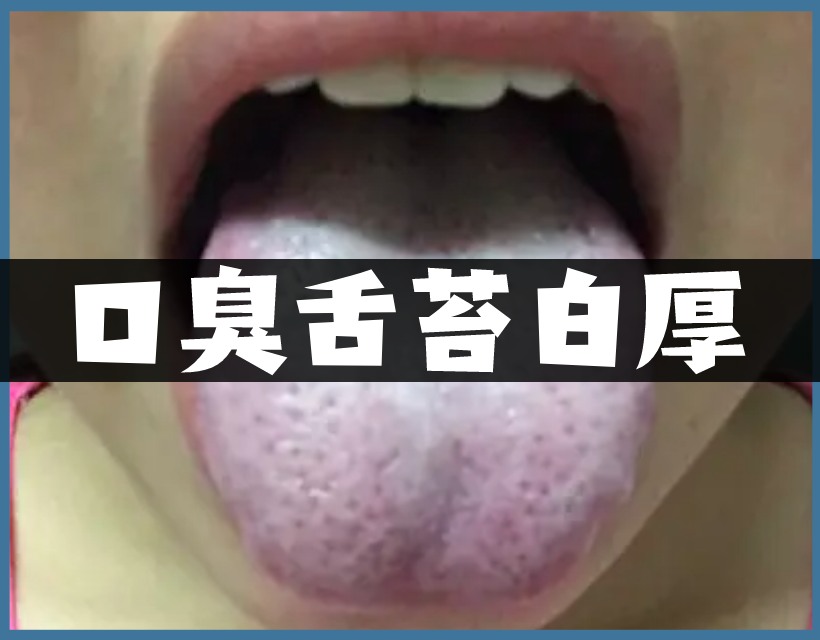 口臭舌苔