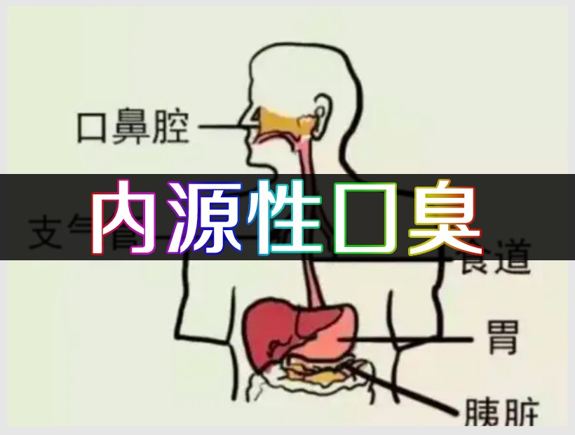 内源性口臭示意图