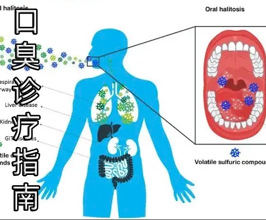 口臭示意图