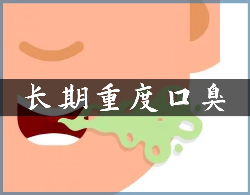 口臭严重