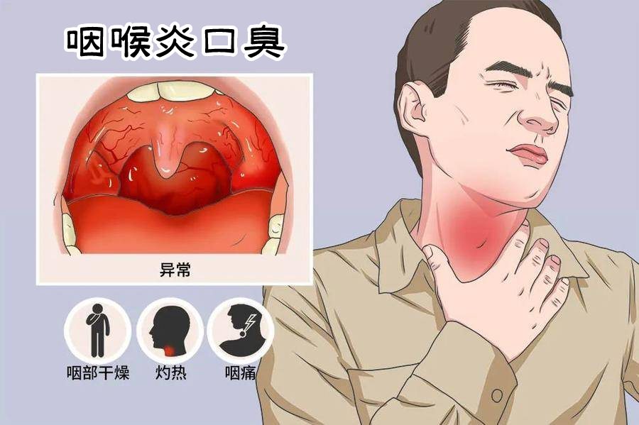 咽喉炎症图