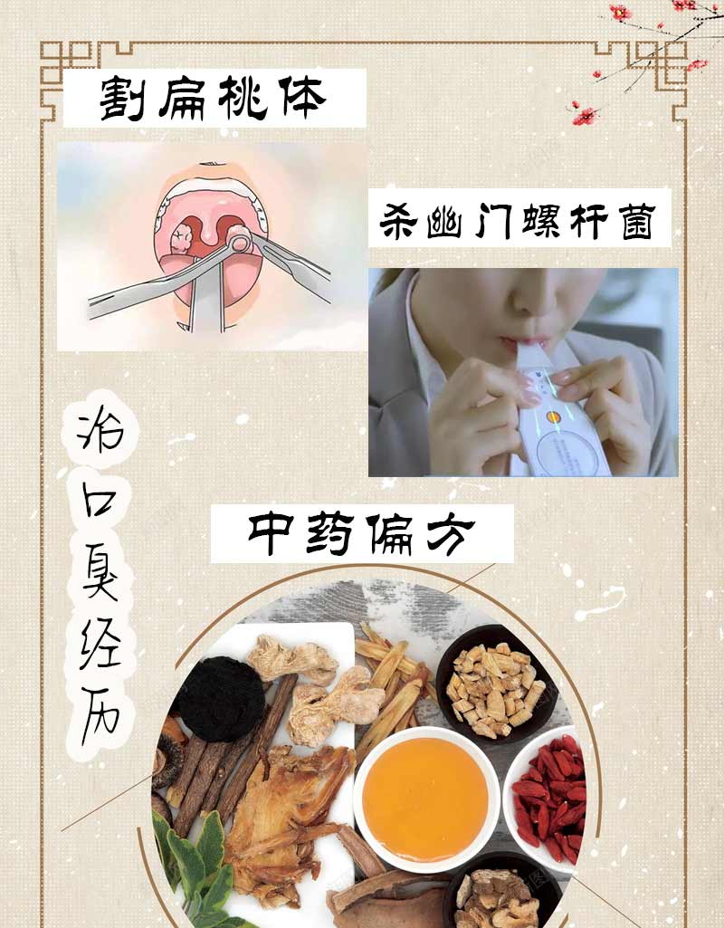 口臭治疗方式
