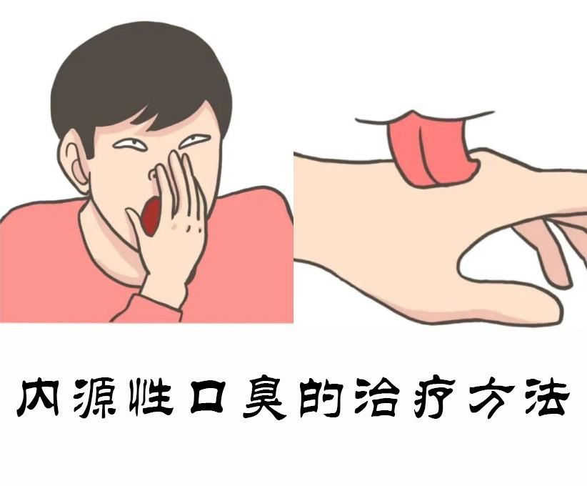 内源口臭
