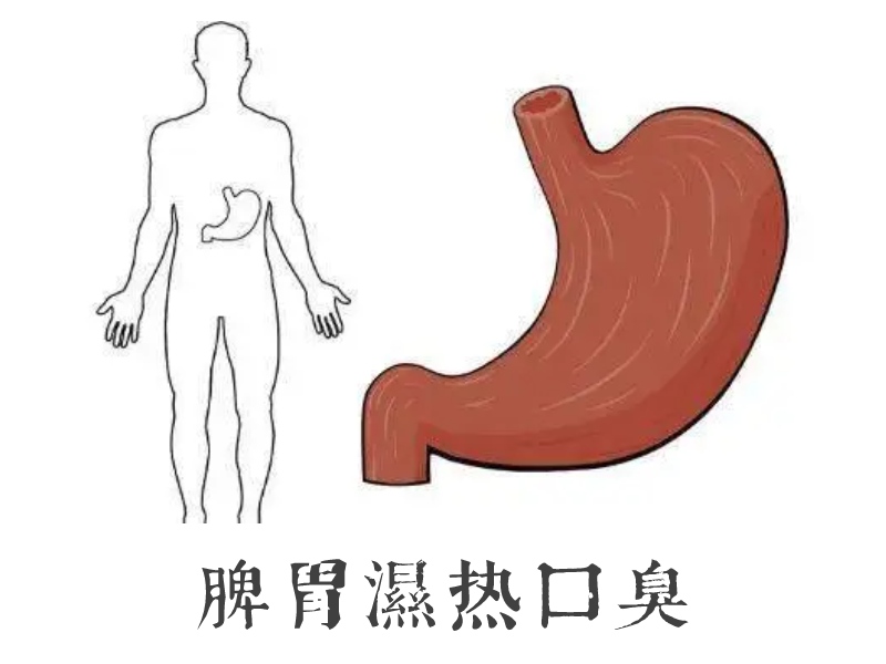 脾胃口臭