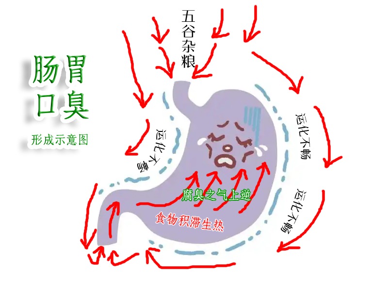 肠胃口臭形成图