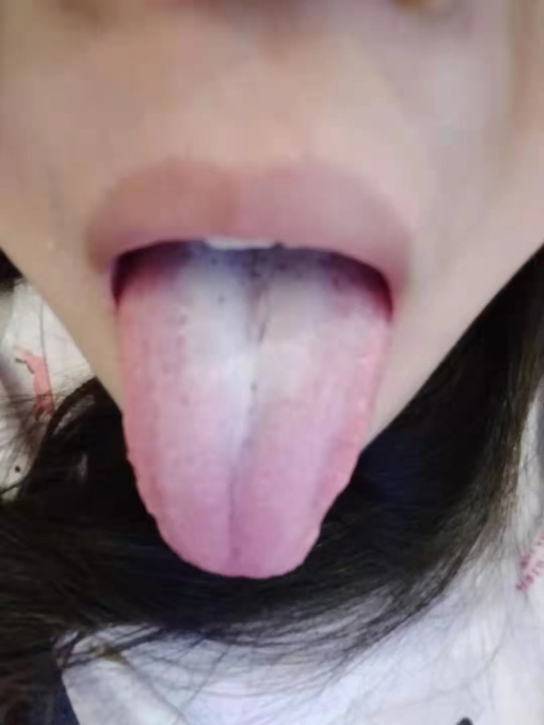 舌苔照