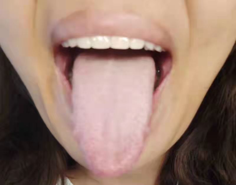 真实舌苔
